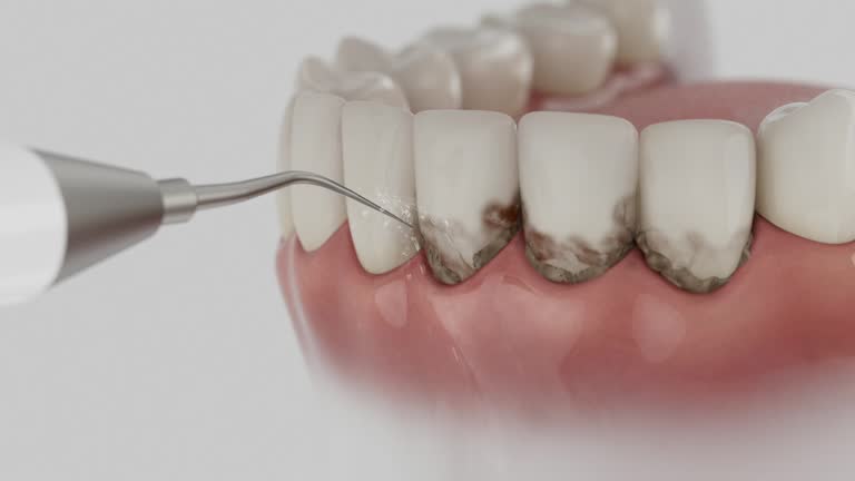 Reliable Dental contractor in Langdon, ND by Smile Center Dentistry